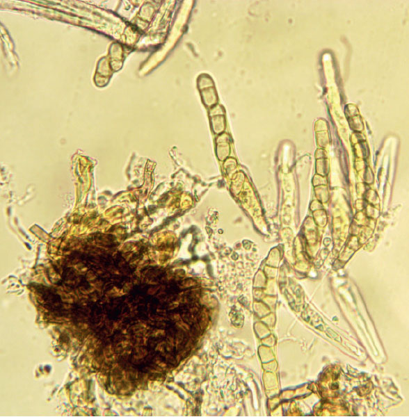 Плодовое тело парши яблони с асками и аскоспорами Плодовое тело парши яблони с асками и аскоспорами